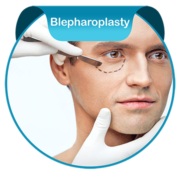 Blepharoplasty in Iran